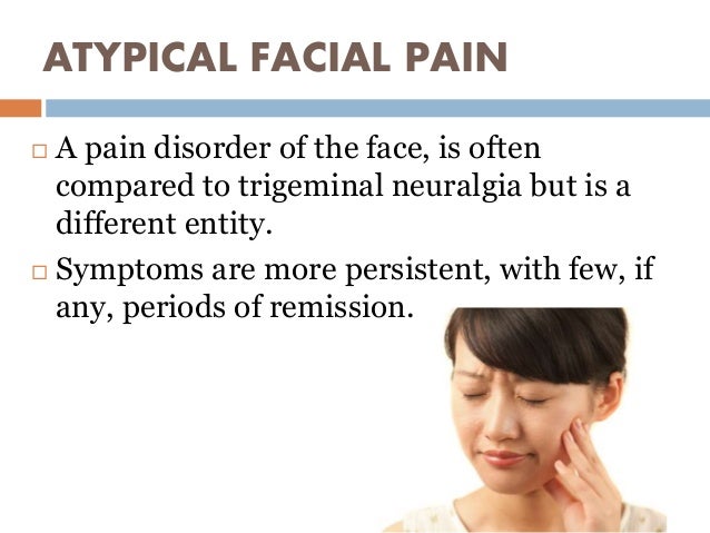 Facial pain syndrome